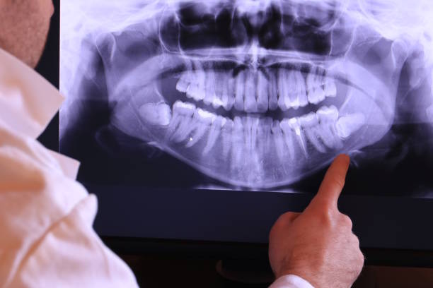 Best Cosmetic Emergency Dentistry in Chackbay, LA