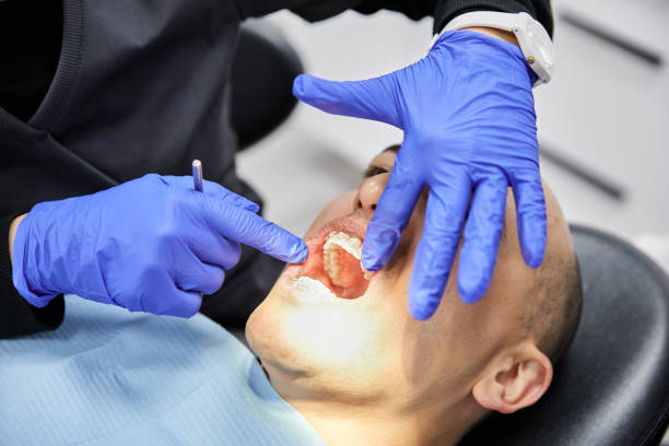 Best Emergency Gum Treatment in Chackbay, LA